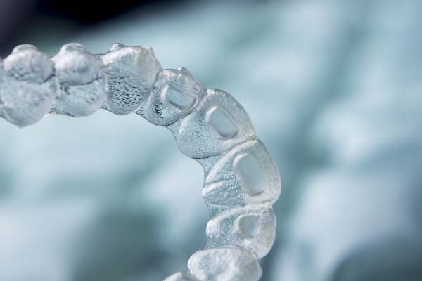 Understanding The Process Behind ClearCorrect®