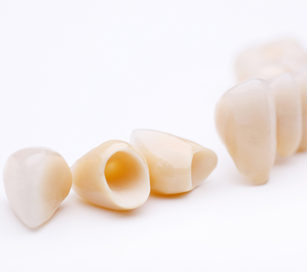 San Clemente Dental Crowns and Dental Bridges