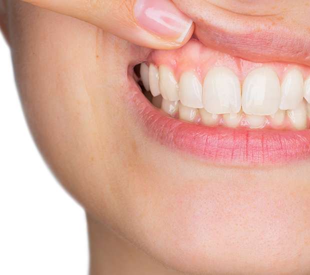 San Clemente Gum Disease