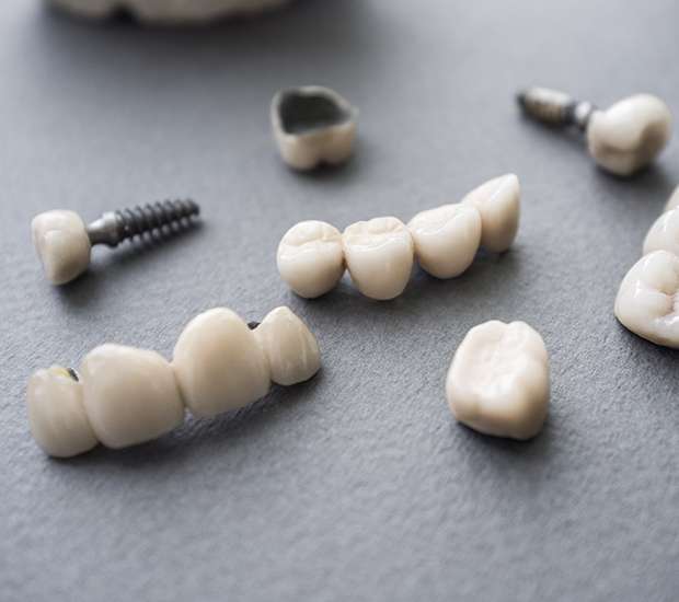 San Clemente The Difference Between Dental Implants and Mini Dental Implants