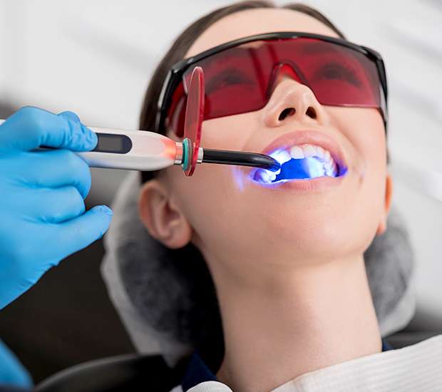 San Clemente Professional Teeth Whitening